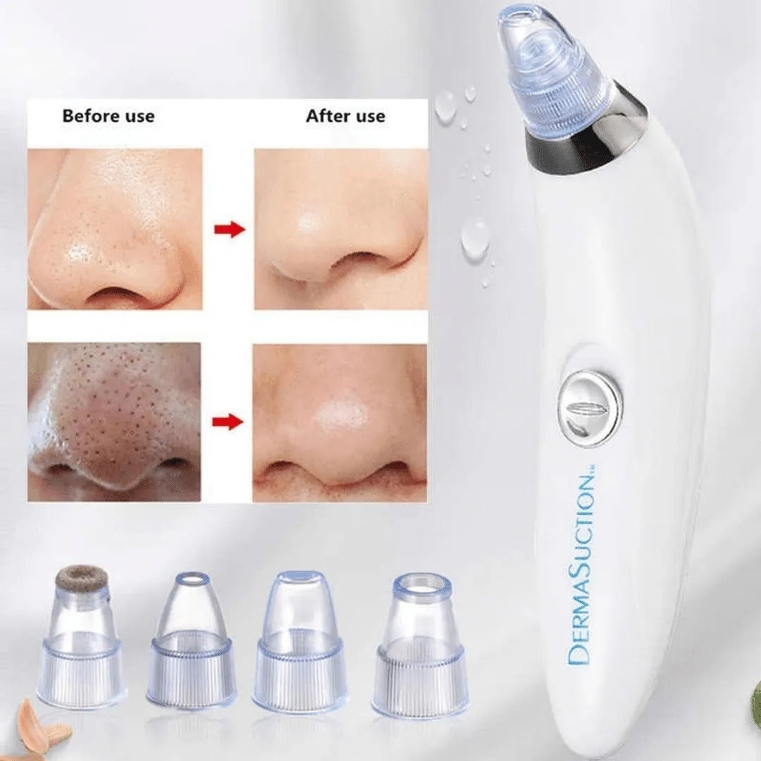 Aparat de curățare a porilor Derma Suction, cu acțiune pe bază de vacuum