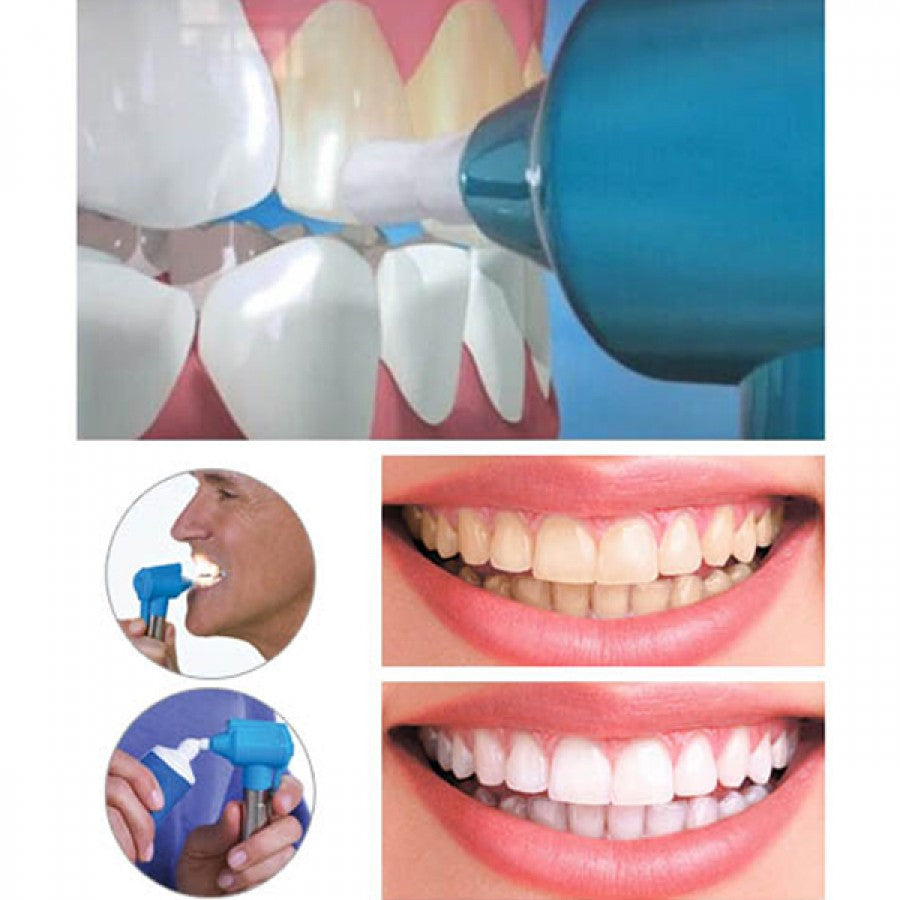 Aparat Albire Dinti Smile Original Oferta Limitata