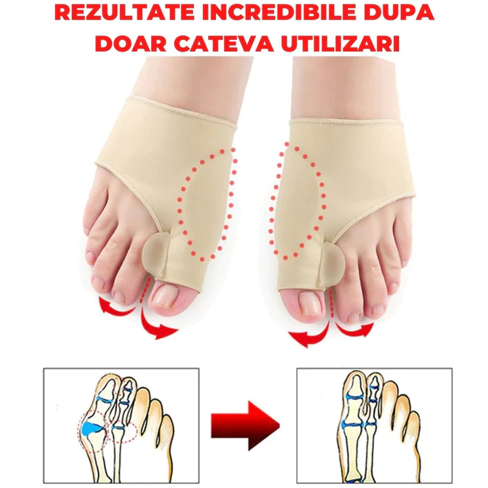 SET 2 CORECTOARE MAGICE PENTRU MONTURI
